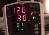 VS800 RESP NIBP SPO2 Used Patient Monitor Mindray  Cardiac Monitor