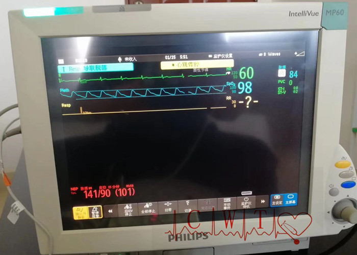 2nd Hand 50mm/S Hospital Monitoring System , 12 Inch Icu Bedside Monitor