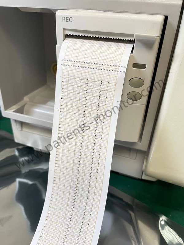 Philip MP50 Patient Monitor Parts Thermal Array Recorder M1116B Printer Recorder
